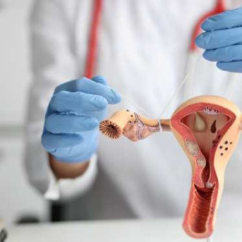 (P) FIV ca standard de ingrijire in absenta functionalitatii trompelor uterine