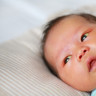 Icterul la bebelusi - cum il tratati corect