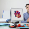 Bypass coronarian: tot ce trebuie sa stiti despre bypass-ul la inima