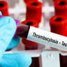 Trombocitoza (trombocite crescute) – cauze si tratament