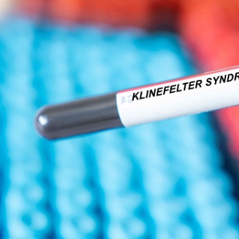 Sindromul Klinefelter la adulti: ce este, probleme de sanatate asociate si managementul lor