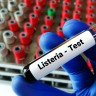 Listerioza: simptome, cauze si tratament