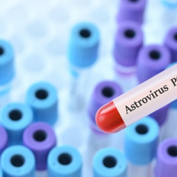 Infectia cu astrovirus: ce este, ce cauze are, manifestari clinice si tratament
