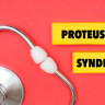Sindrom Proteus: ce este, cauze, simptome, tratamente inovatoare, management