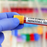 Managementul hepatitei B si hepatitei C in sarcina