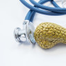 Adenocarcinom: ce este, cauze, factori de risc, diagnostic si tratament
