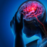 Accident Vascular Cerebral (AVC): Tot ce trebuie sa stii