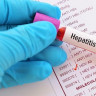 Hepatita D (HVD). Ce este si cum se manifesta