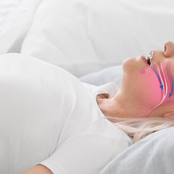 Apneea in somn netratata poate dubla riscul de Parkinson