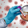 Febra Dengue: cauze, simptome, diagnostic, tratament si preventie