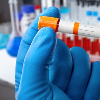 Anemia Fanconi: ce este, cauze genetice, simptome, diagnostic si tratament