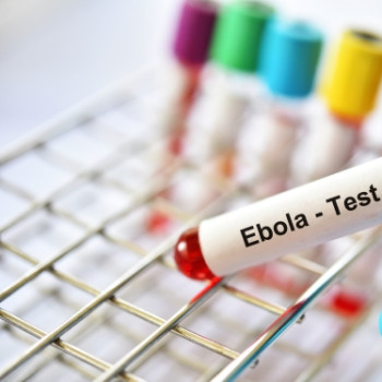 Ce este si cum se transmite virusul Ebola?