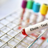 Ce este si cum se transmite virusul Ebola?