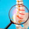 Spondilolistezis: tipuri, cauze si factori de risc, simptome, tratament, preventie