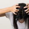 Ciuperca scalpului (micoza scalpului) - cauze si tratament