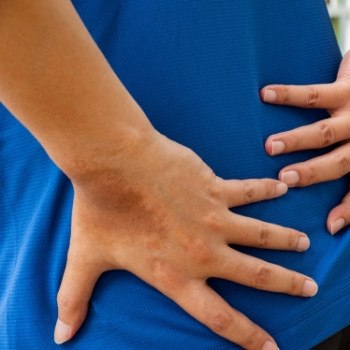 Hernia de disc si durerea de picior: ce legaturi exista