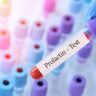 Hiperprolactinemie: cauze si factori de risc, simptome, diagnostic si solutii
