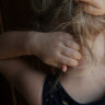 Eczema vulgara: cauze, simptome, diagnostic si tratamente