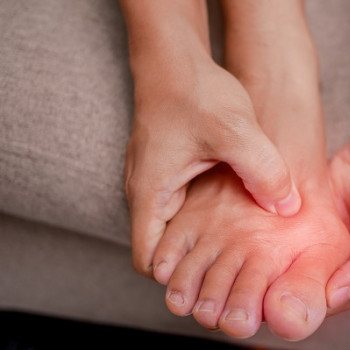 Monturi (hallux valgus): ce sunt, ce cauze au, simptome si tratament