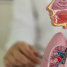 Traheobronsita: ce este, simptome, cauze, tratament si preventie