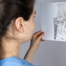 Articulatie temporo mandibulara: anatomie si functii