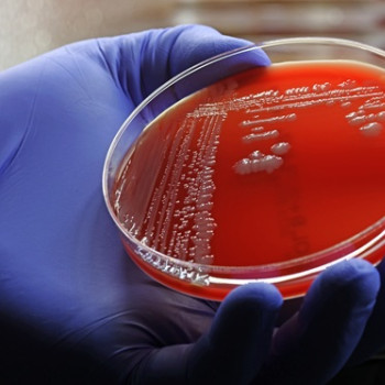 Infectia cu stafilococul rezistent la meticilina (MRSA): simptome, cai de transmitere si tratament