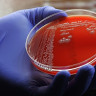 Infectia cu stafilococul rezistent la meticilina (MRSA): simptome, cai de transmitere si tratament