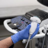 Eco Doppler vascular: cand se recomanda si cum se realizeaza