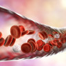 Curatarea vaselor de sange – ce inseamna si care sunt alimentele care ajuta