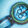 Fertilizare in vitro (FIV) – etape, recomandari, temeri si riscuri