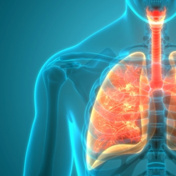 Sarcoidoza pulmonara – cauze, diagnostic si tratament
