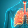 Sarcoidoza pulmonara – cauze, diagnostic si tratament