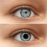 Mioza: cauze si tratament pentru micsorarea pupilelor