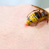 Intepatura de viespe - cum s-o recunoasteti si cum sa actionati corect