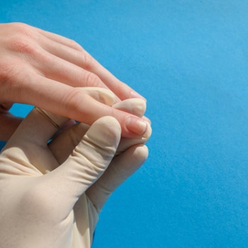 Piodermita: ce este, de ce apare, simptome, diagnostic si tratament