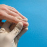Piodermita: ce este, de ce apare, simptome, diagnostic si tratament