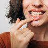 Retractie gingivala: cauze frecvente si solutii reale