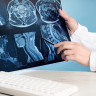 Encefalocel: cauze, simptome, diagnostic si tratament