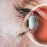 Lacrimarea ochilor – factori de risc, cauze si afectiuni asociate