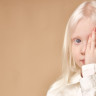 Ce trebuie sa stiti despre albinism: cauze si tratament