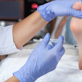 Picior cav sau picior scobit: simptome, diagnostic si solutii de tratament