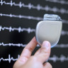 Informatii complete despre implantarea unui stimulator cardiac