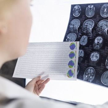 Electroencefalograma: ce este, ce rol are, cand se recomanda