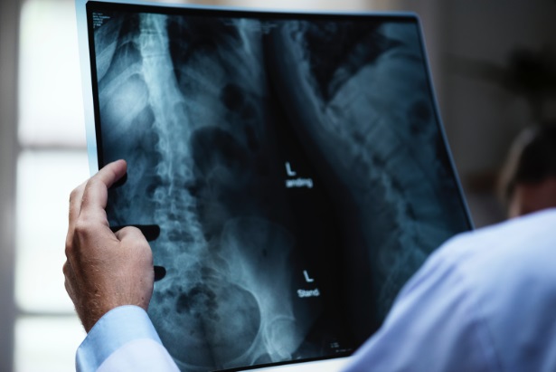 osteoartrita articulațiilor periferice și medicația coloanei vertebrale