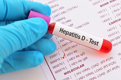 slăbiciune și dureri articulare cu hepatită