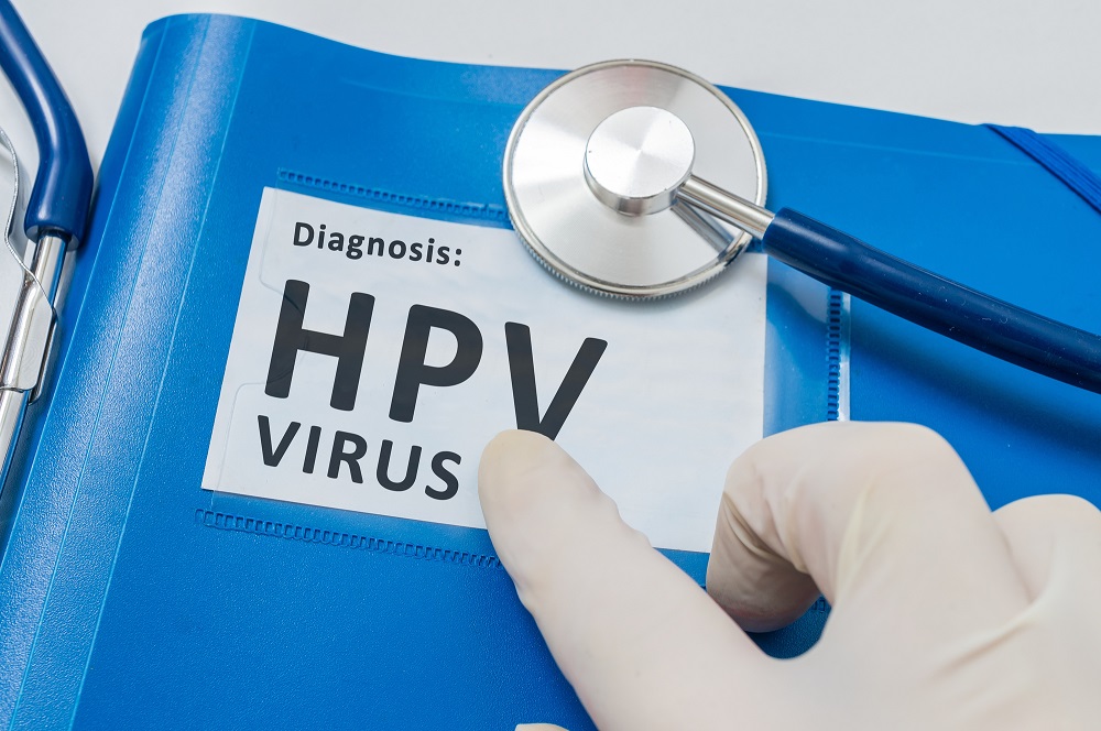 Unguente HPV pentru femei