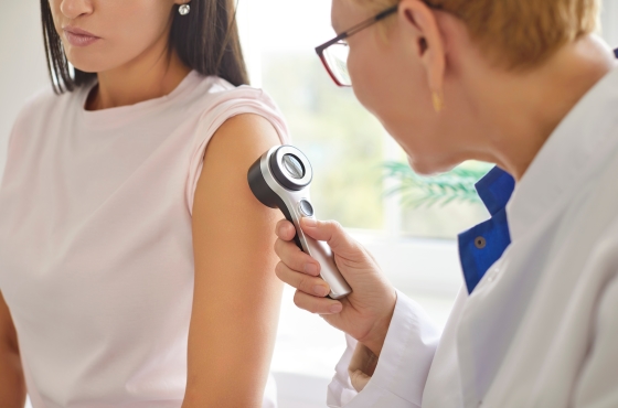 cancer-de-piele-tipuri-cauze-tratament