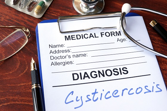 Cisticercoza