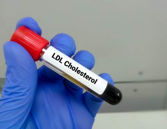 colesterol-ldl
