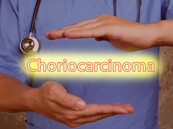 Coriocarcinom